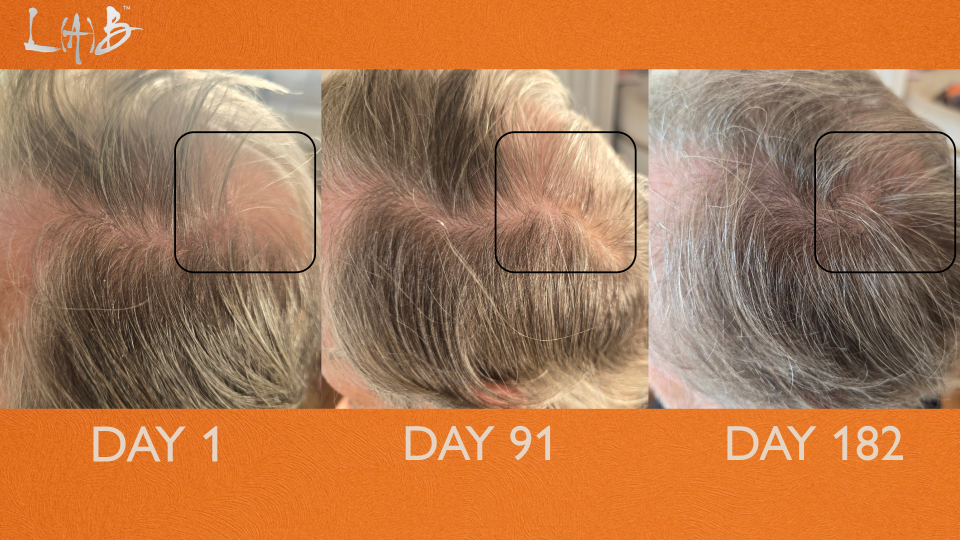 INCREMENTUM THE HAIRBRUSH