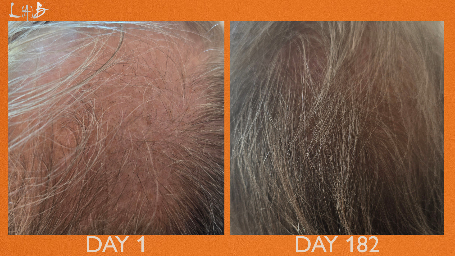 INCREMENTUM THE HAIRBRUSH