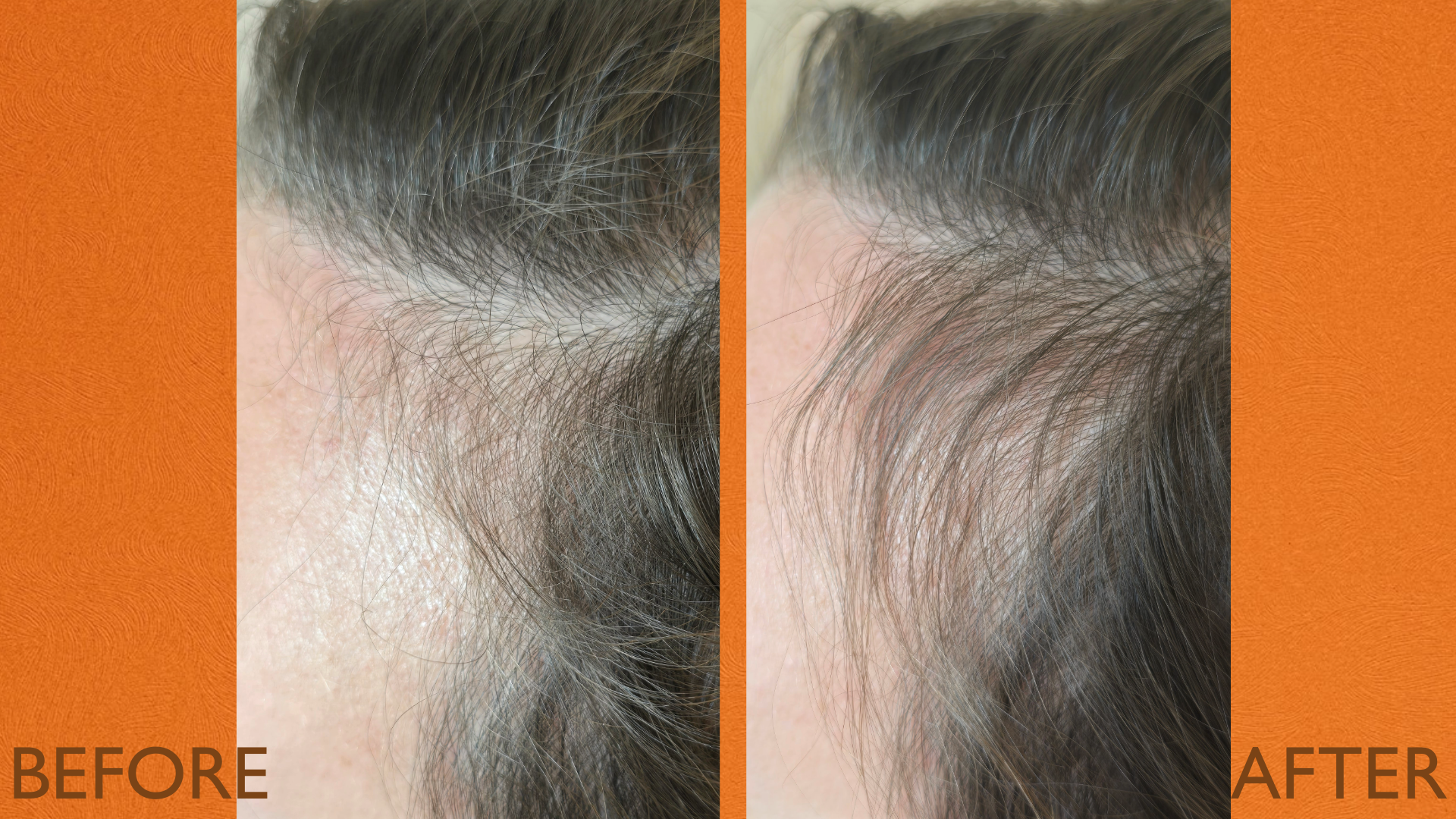 INCREMENTUM THE HAIRBRUSH