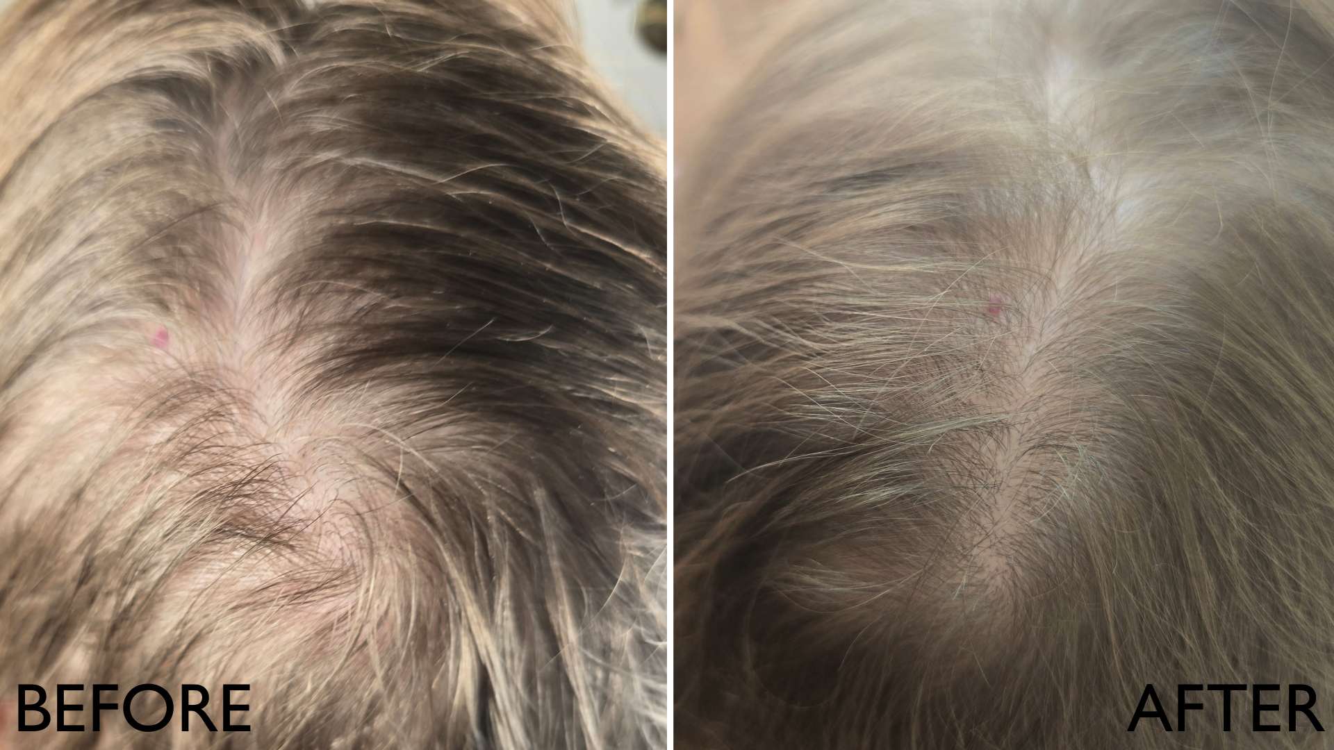 INCREMENTUM THE HAIRBRUSH