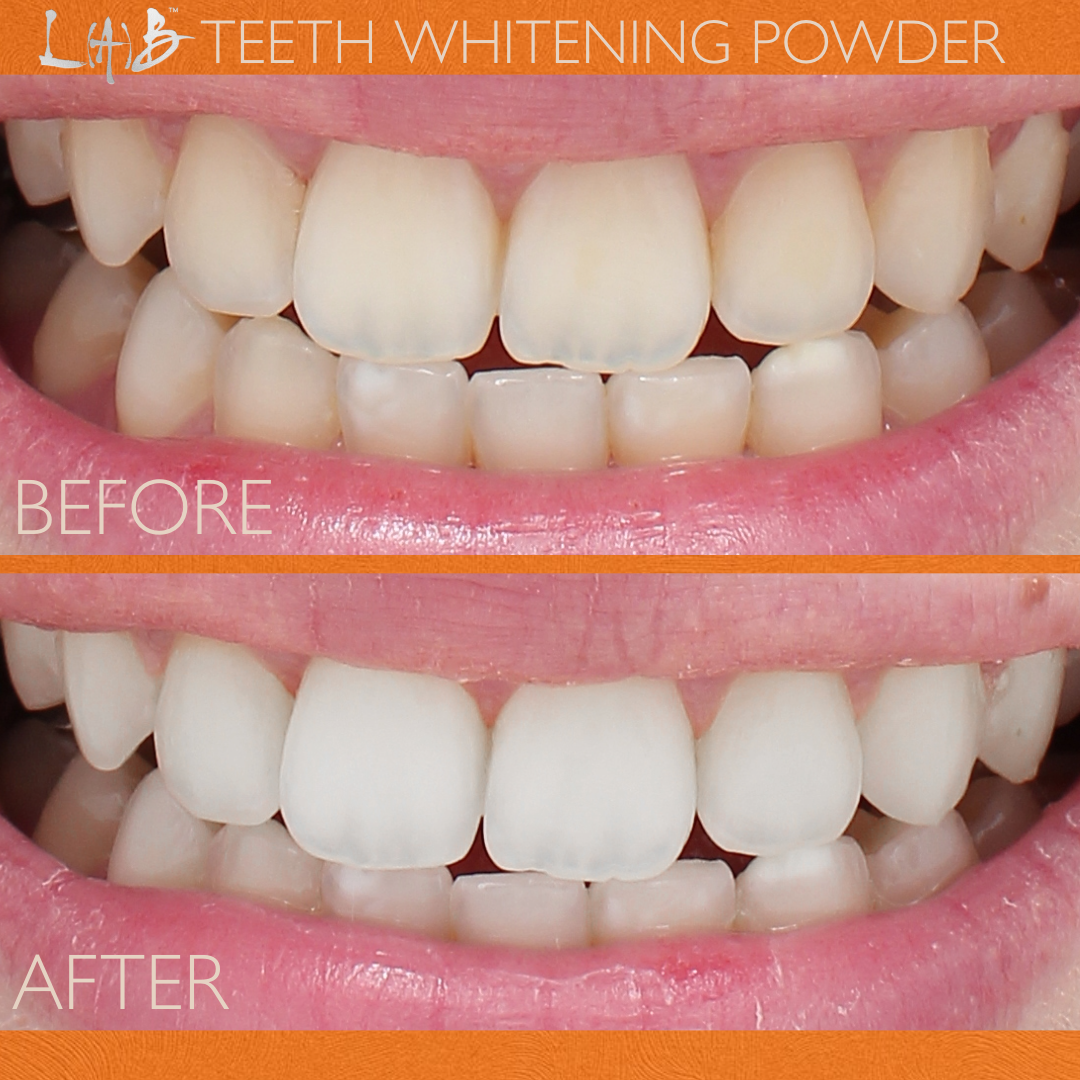 TEETH WHITENING POWDER