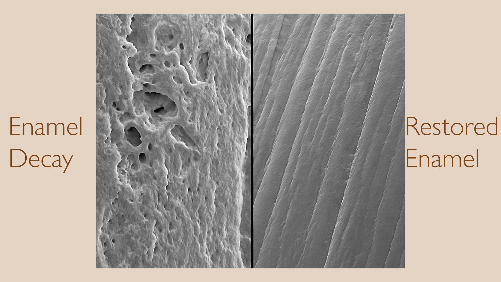 ENAMEL SENSITIVITY SERUM