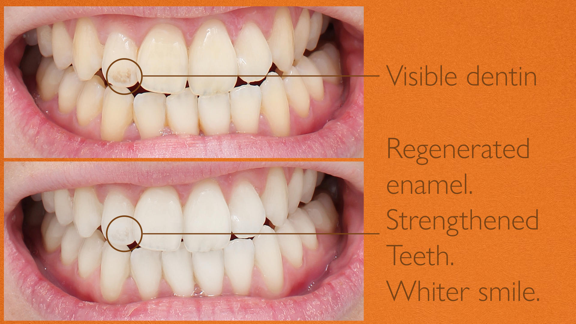 ENAMEL SENSITIVITY SERUM