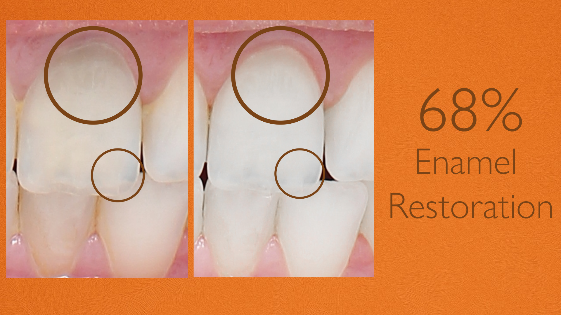 ENAMEL SENSITIVITY SERUM