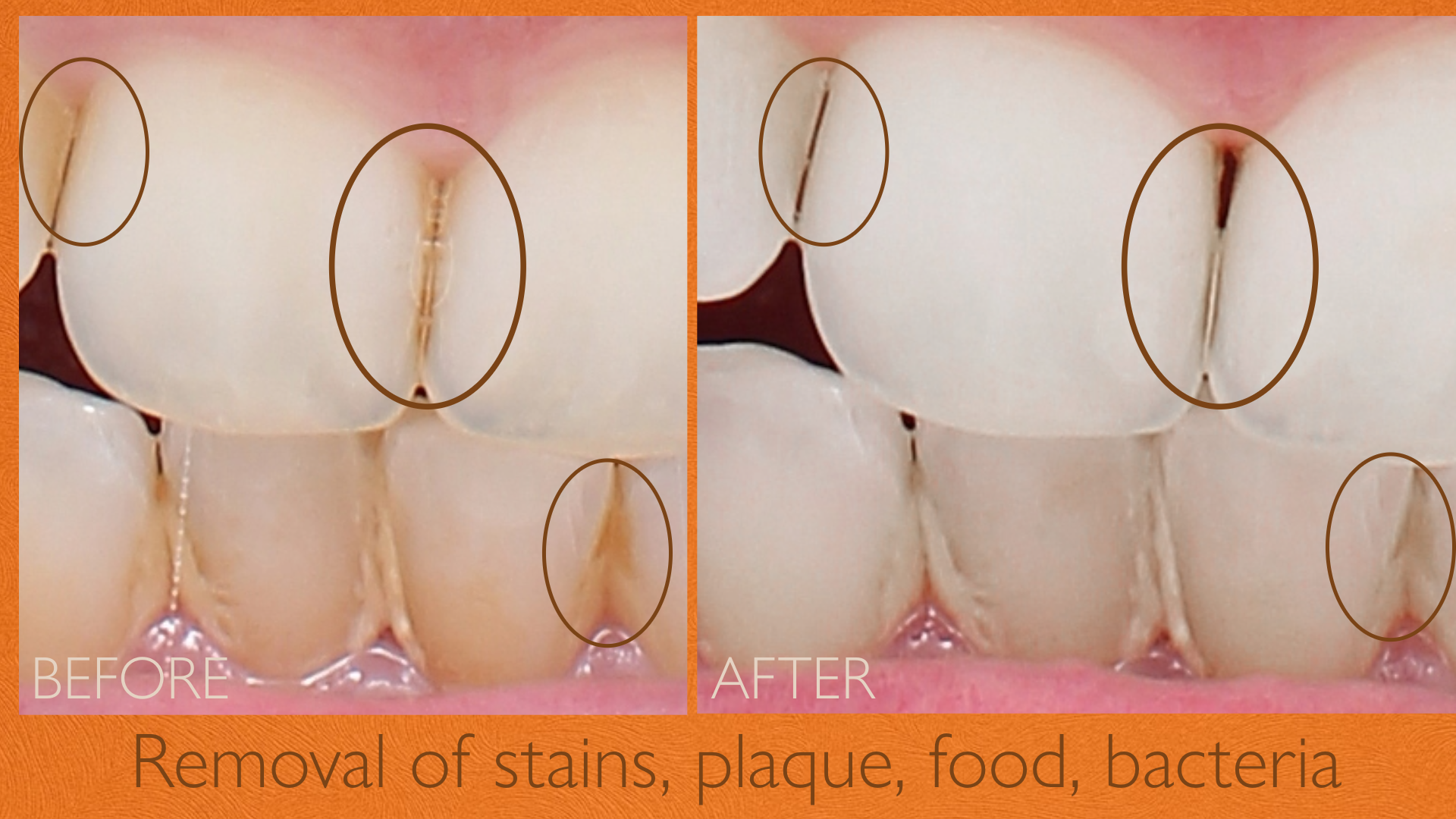 FLOSS LIGHT REPLACEMENT HEADS