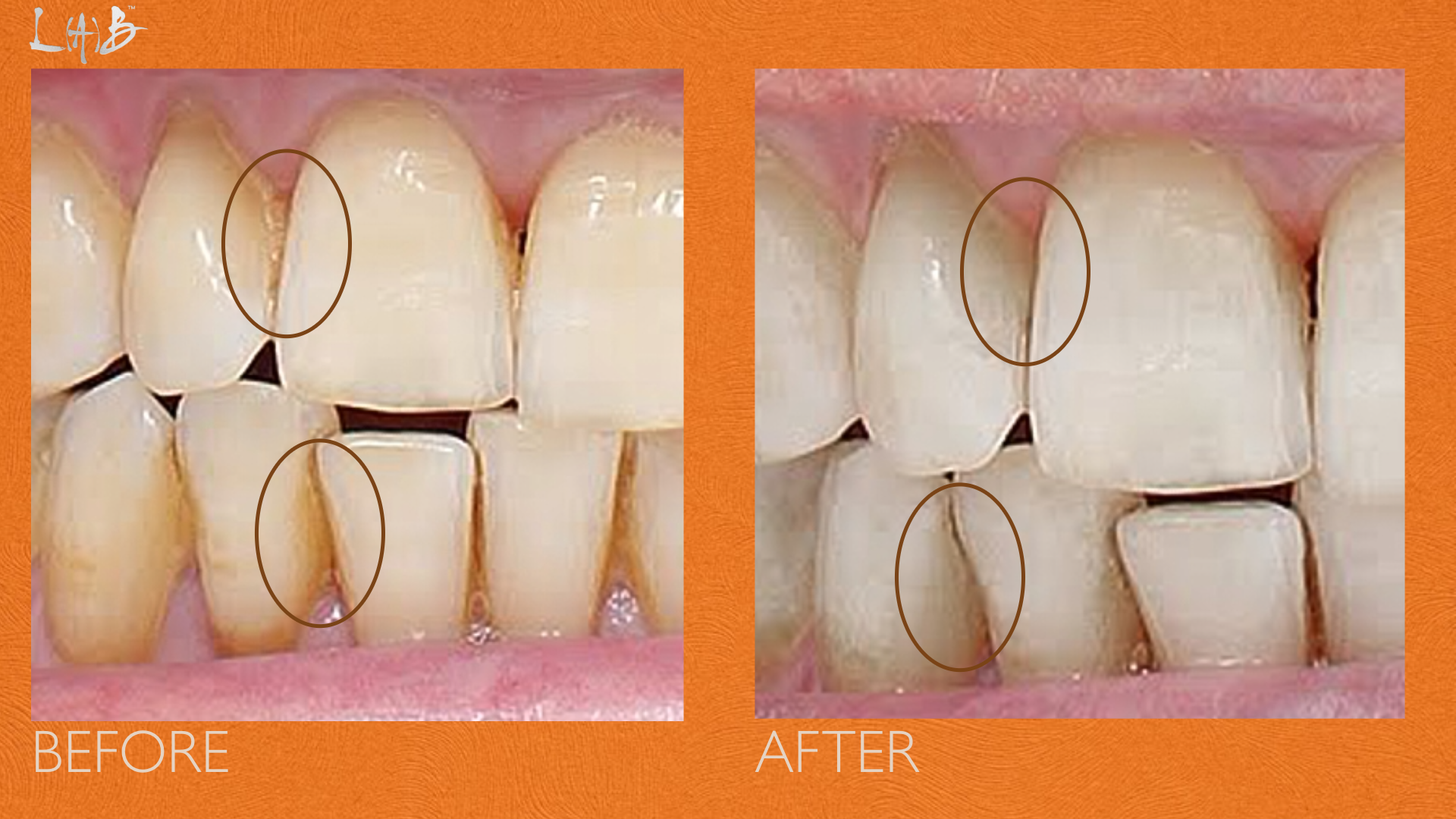 FLOSS LIGHT REPLACEMENT HEADS