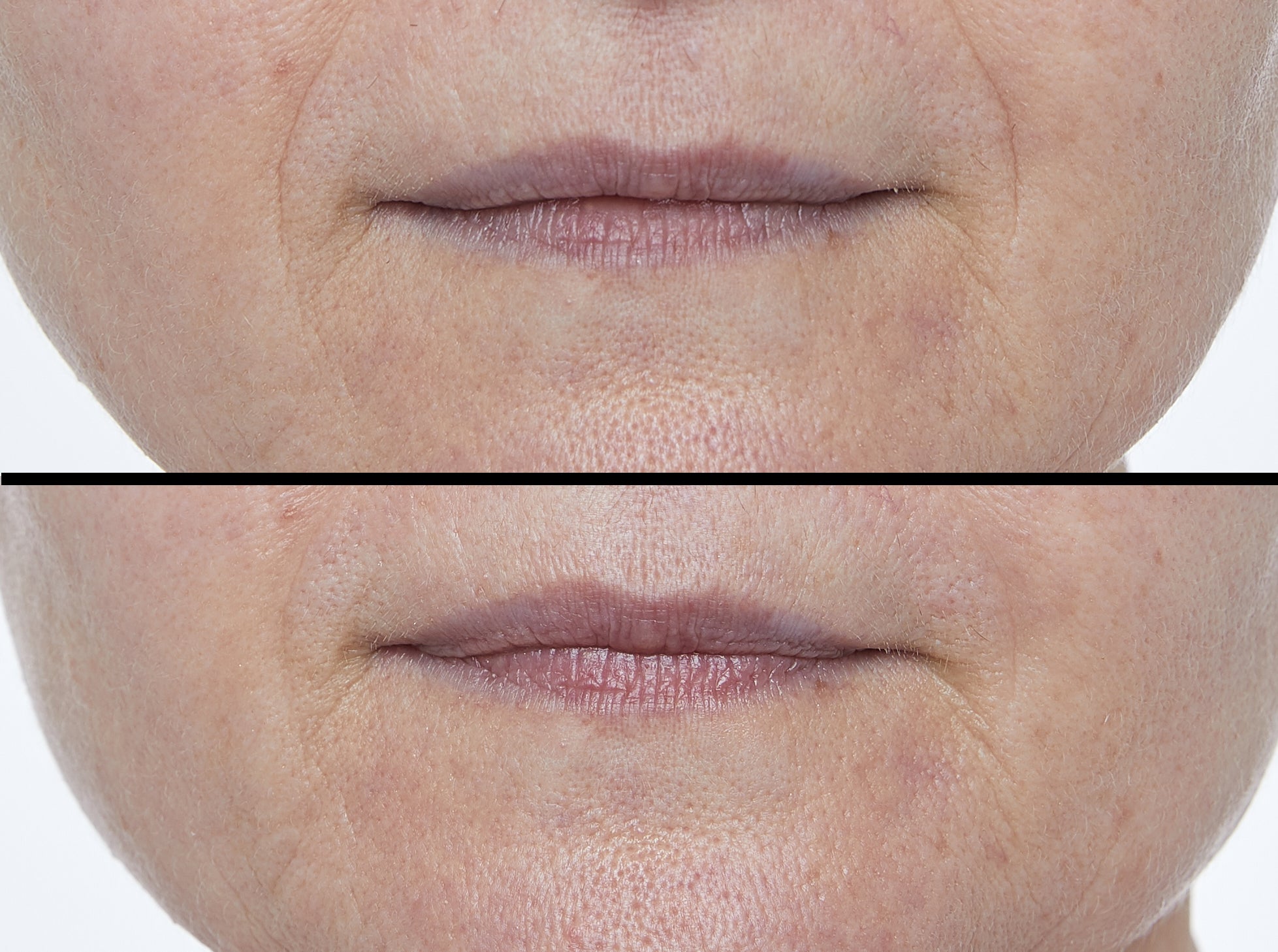 PHOTON TARGETED RESULTS