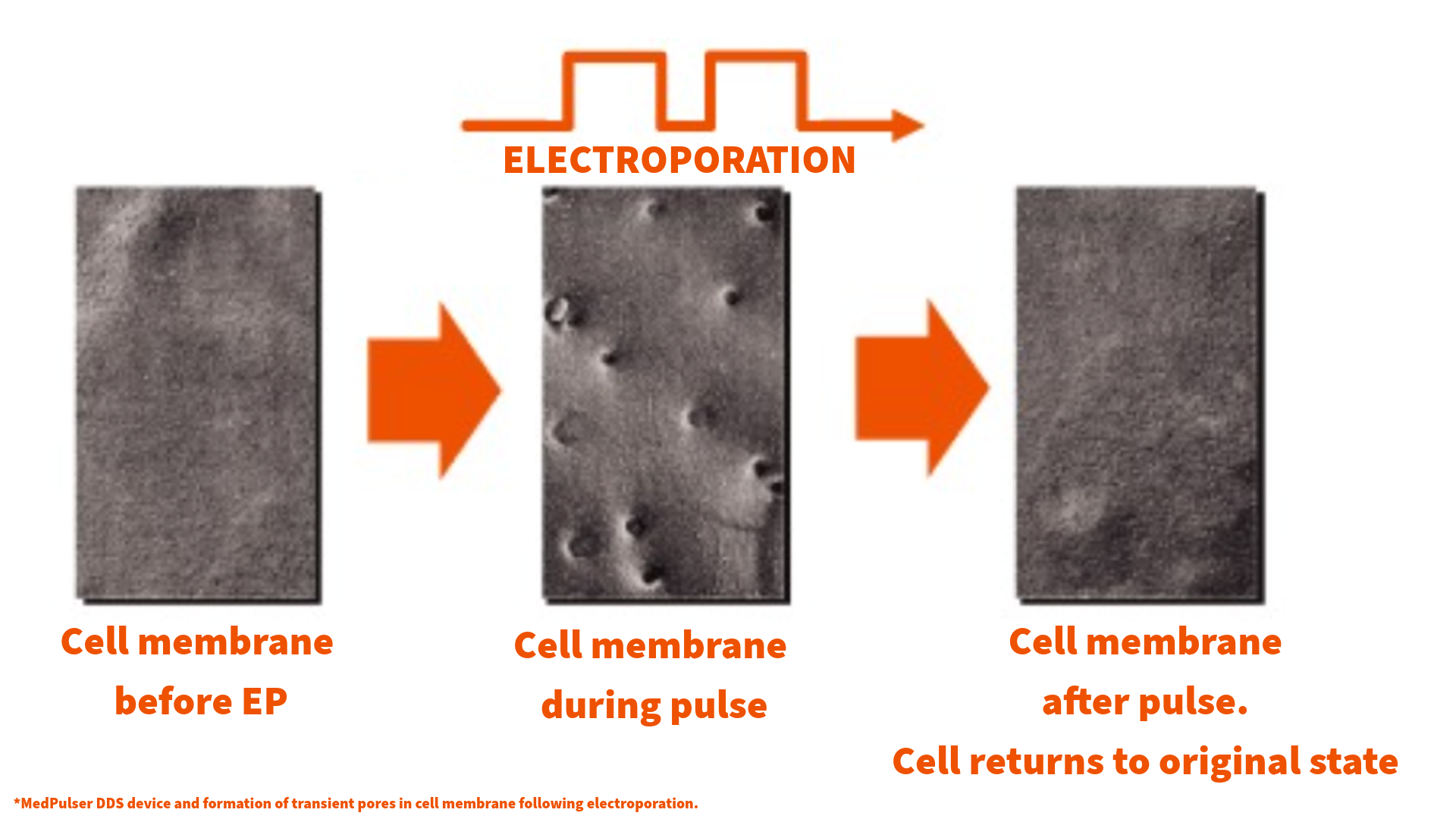 ELECTROPORATION