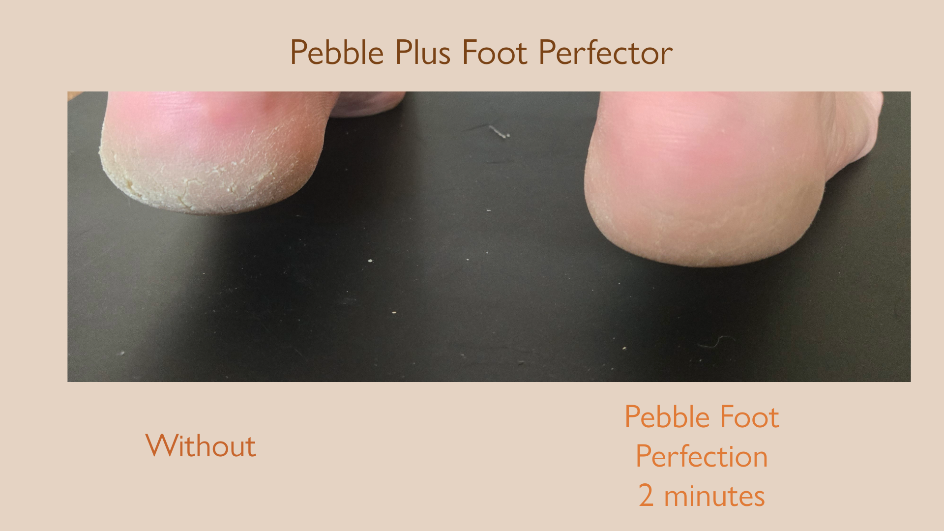PEBBLE PLUS